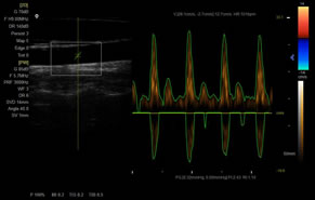 XF-7800彩色多普勒超聲診斷儀成像展示
