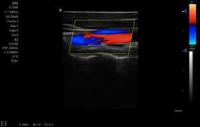 XF-7800彩色多普勒超聲診斷儀成像展示